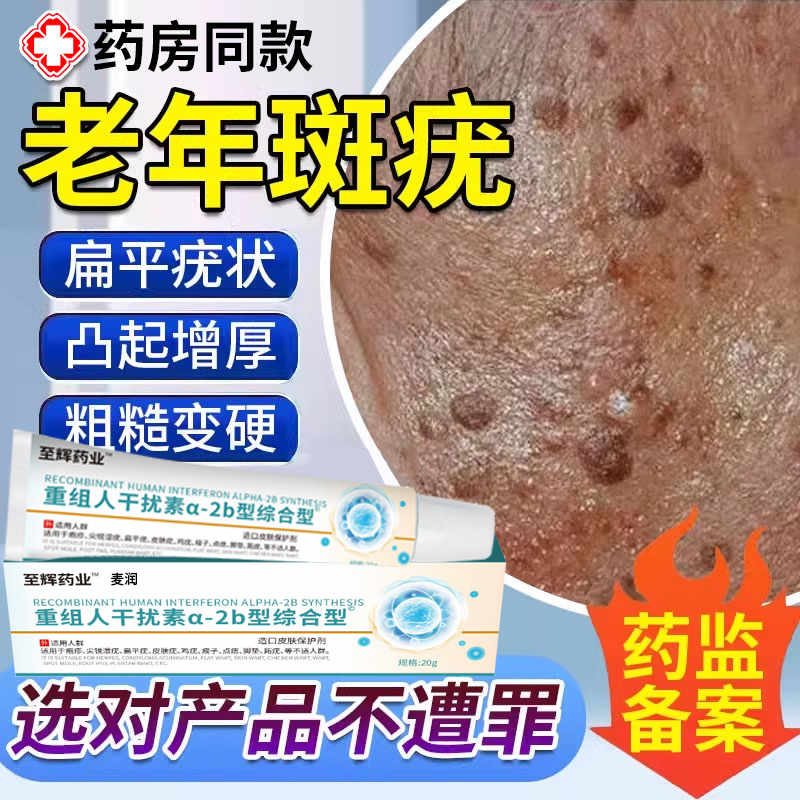 去扁平疣官方旗舰店老年斑疣扁平疣去除膏一抹灵脸上肉粒疙瘩黑LB