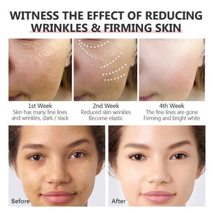 Serum Anti Line Wrinkle Lift Fine Remover Fade Retinol Aging