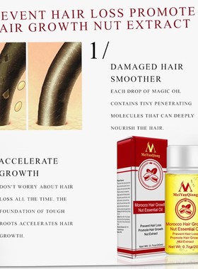 Moroccan Hair Growth Essential Oil Hair Loss Treatment Preve