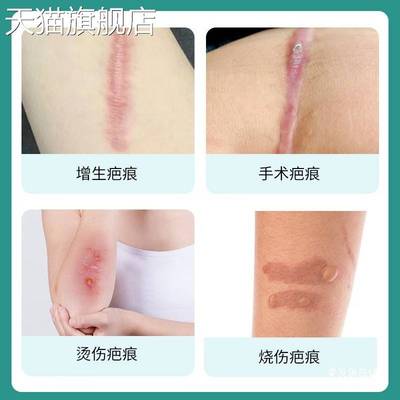 旗舰店官方正品疤痕膏30g每瓶舒缓皮肤疤痕不适增