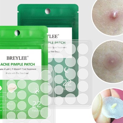 Acne Pimple Patch  Stickers Acne Treatment Pimple Remover