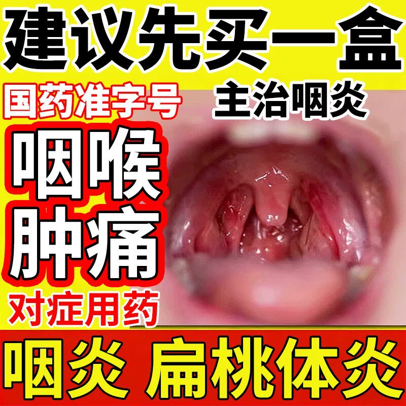 治嗓子疼咽喉炎肿痛喉咙发炎消炎特有新效期药扁桃体专用冬凌草片