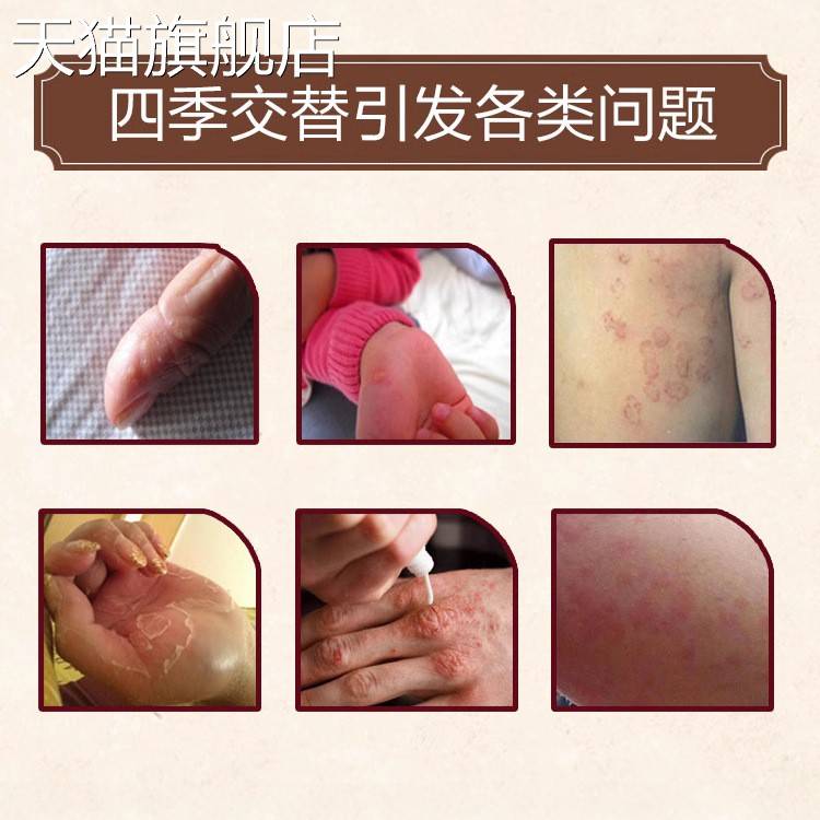 旗舰店官方正品老牌子见笑金皮研霜抑菌外用皮肤乳膏藏研跨境可授