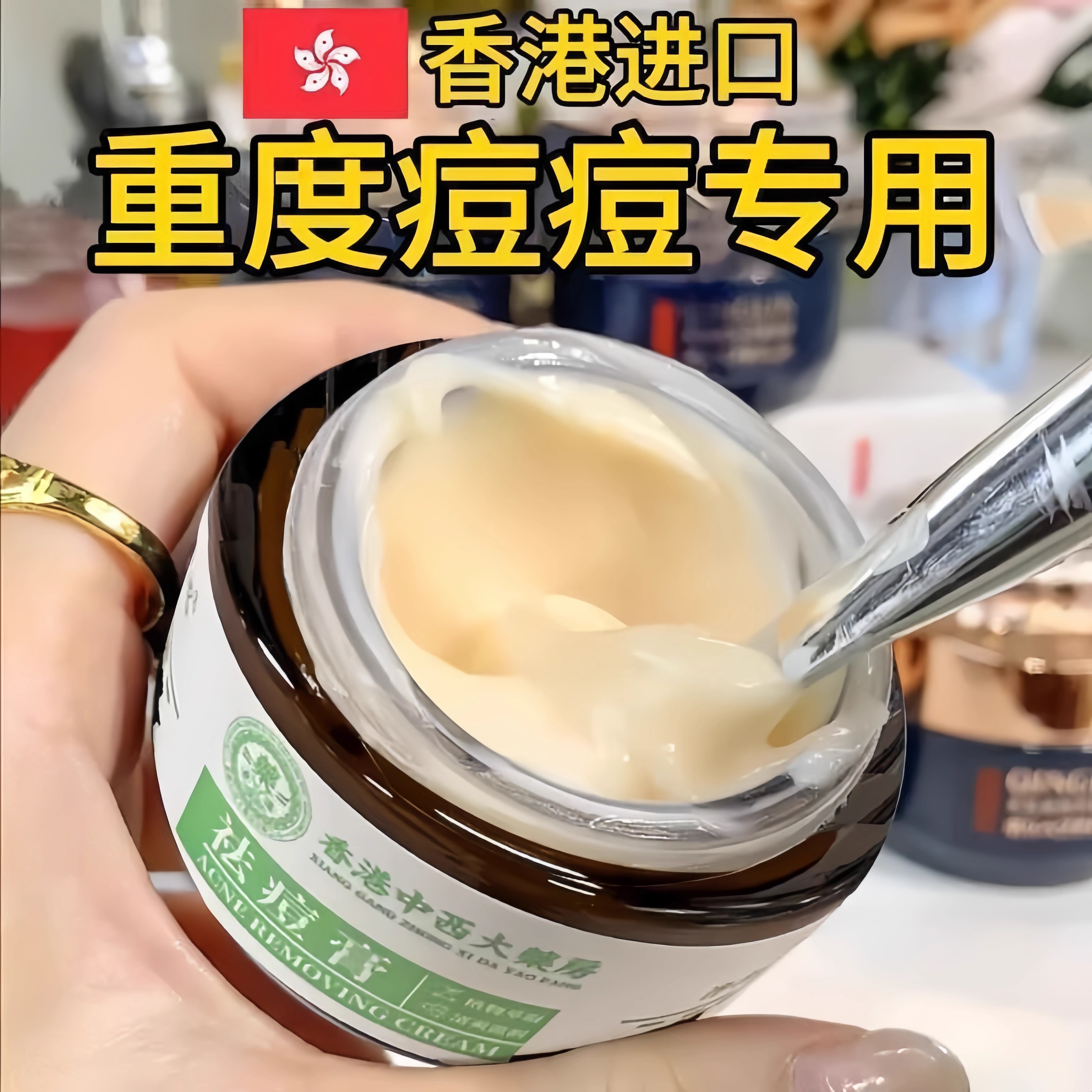 香港中西大药房祛痘药膏修复痘印青春痘淡化痘印痘坑学生官方正品