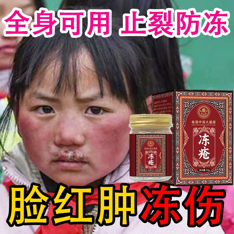 【香港老品牌】冻疮膏防皲裂冻伤秋冬季手脚脸儿童学生男女防冻裂