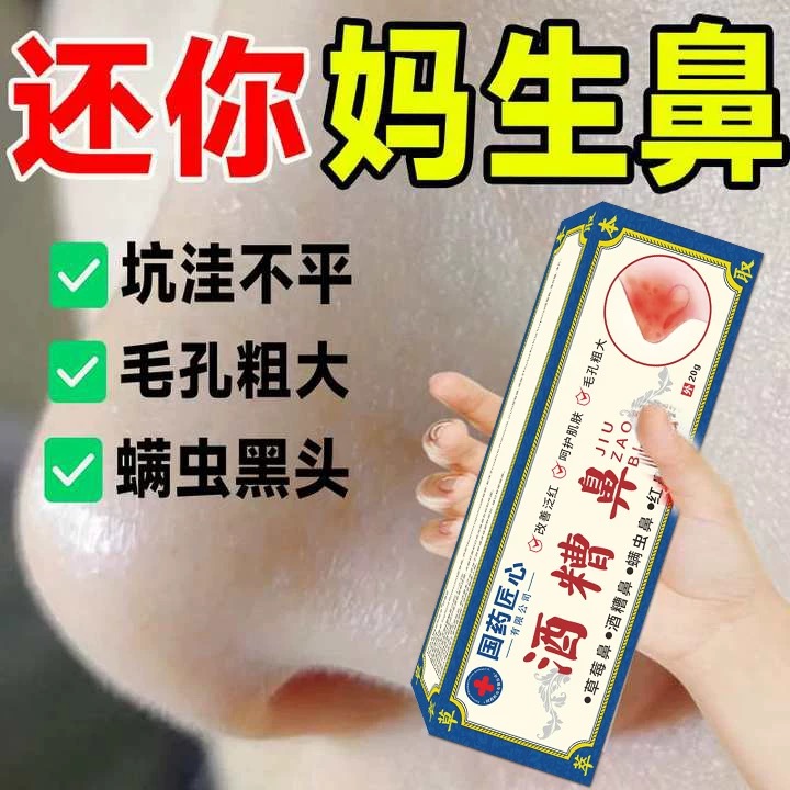 国药酒糟鼻草莓鼻修复鼻子螨清治鼻头去黑头除螨虫毛孔粗大专用药