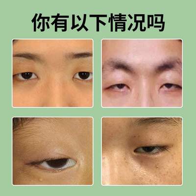 新品眼皮下垂提拉贴上眼睑去肿定型老年人用提拉紧致双眼皮神器防
