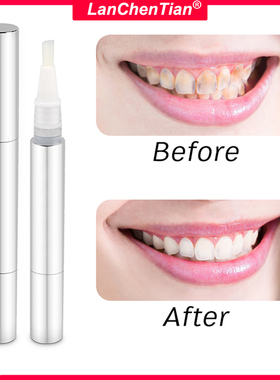Teeth Whitening Pen Optic White Overnight Teeth Stain Remove