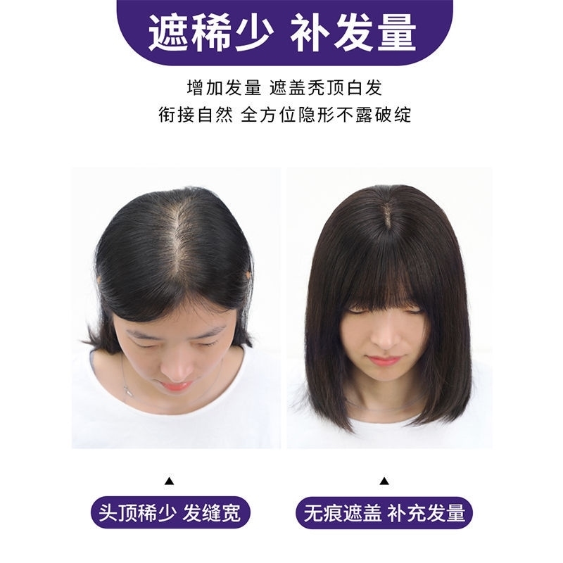 遮白发头饰显年轻假发头顶补发片短发隐形发饰发卡发际线遮盖神器