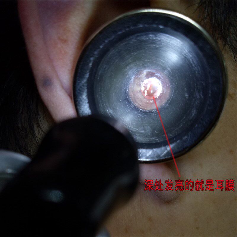 直充电采耳手握灯USB发光掏挖耳朵工具神器扩耳器阿昌新款检耳镜