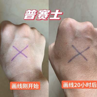 顺丰航空包邮放疗定位记号笔长效皮肤笔防水防汗不晕染人