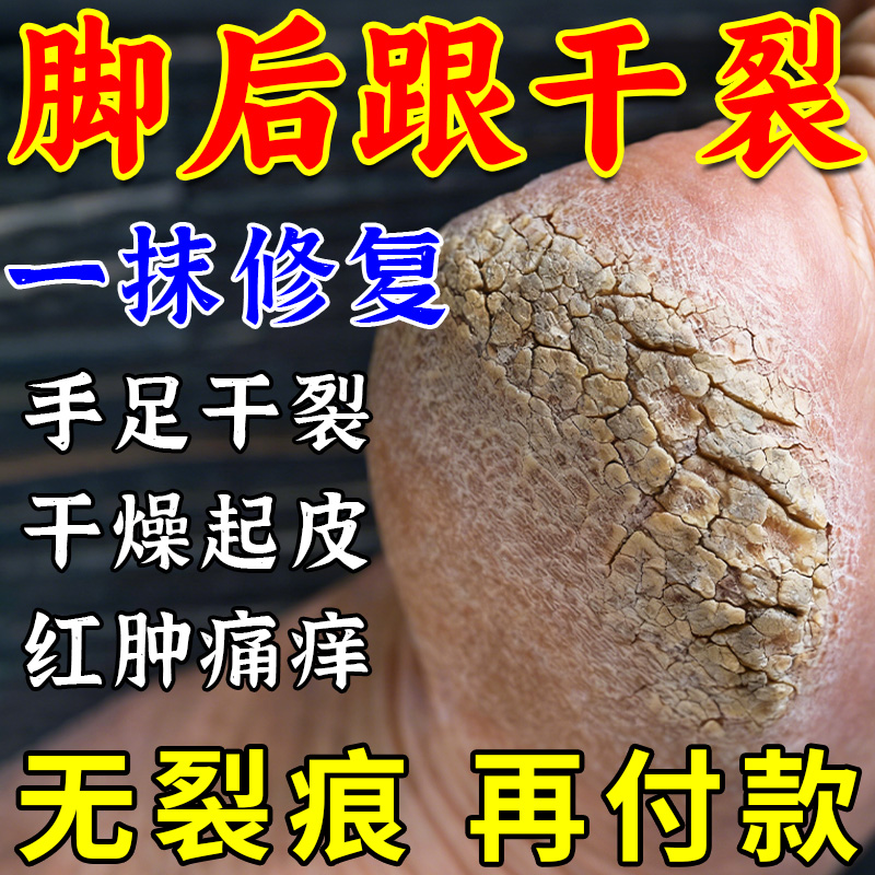 手足干裂修复霜修复膏