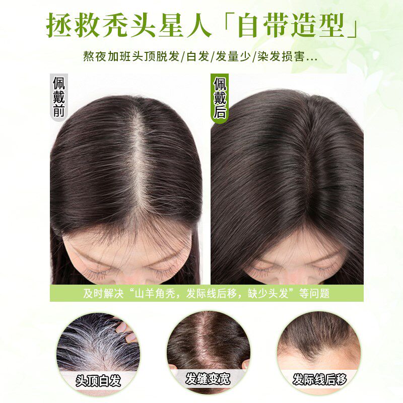 假发女片头顶补发高颅顶增发量遮白发蓬松真发无痕八字刘海假发片