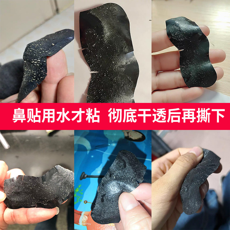 去黑头鼻贴男女学生用清洁毛孔撕