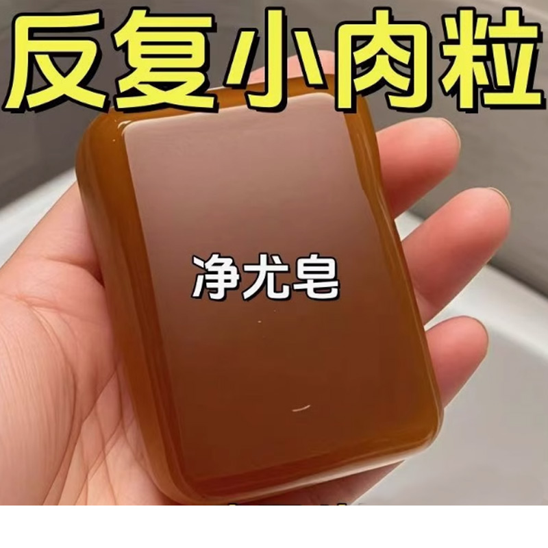 维a酸疣痣皂去疣药皂旗舰店肤康皂除螨身上小肉粒皂去祛清除克疣