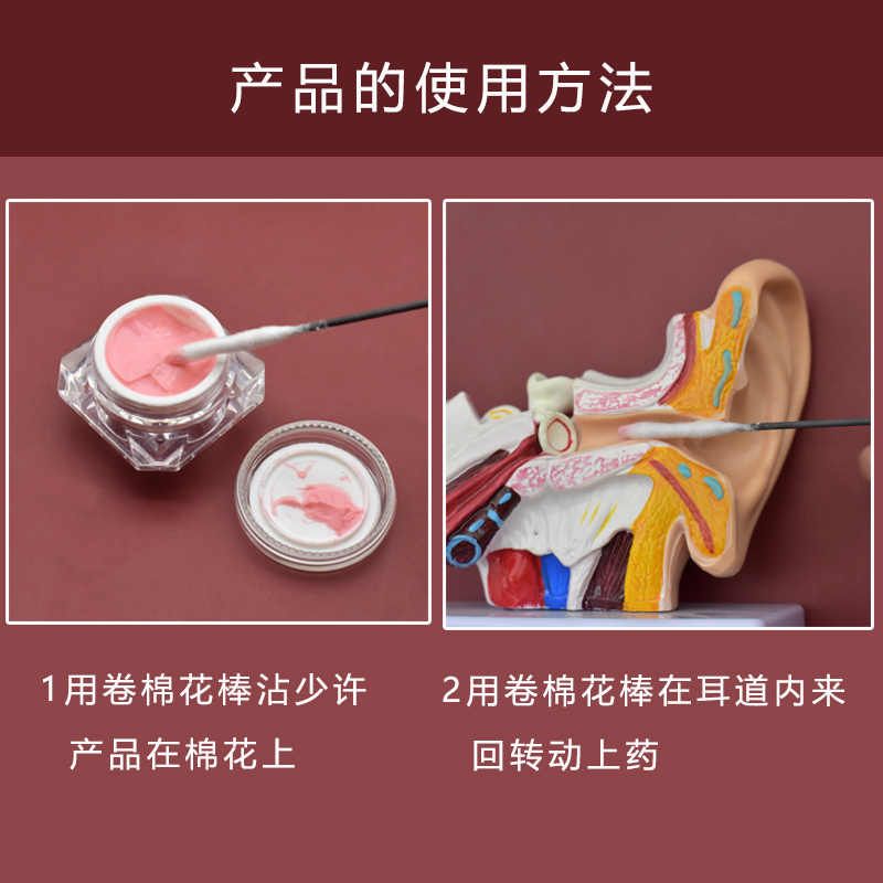 专业采耳工具耳部护理膏滴耳液耳朵清洁专用耵聍耳结石软化水耳痒