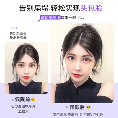 假发片女头顶高颅顶真发垫发片蓬松增发量增多神器无痕跟发头假发