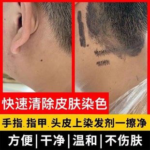 上色残留一擦净染色去除剂祛焗油膏印记除黑剂洁蜡宝清洁液一抹净