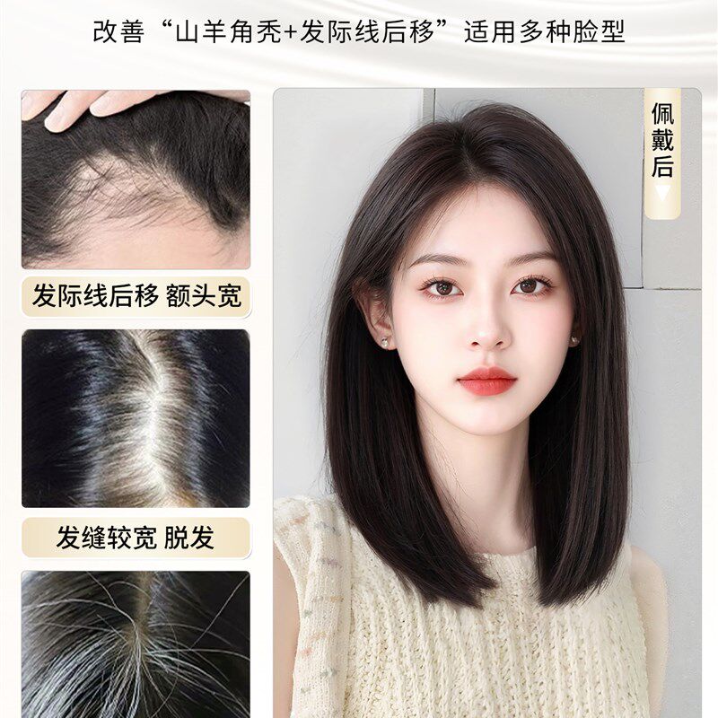 天空树递针假发女片头顶补发全真人发增发量遮白T发前额无边补发