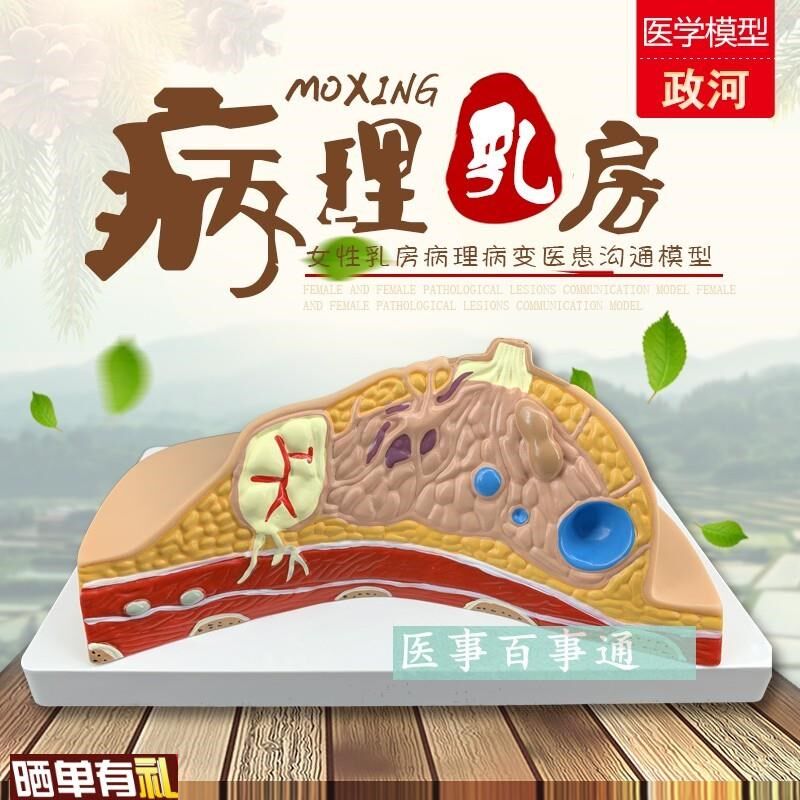 义乳病变模型女性月p嫂培训病理模型催乳师护理模型培训模具