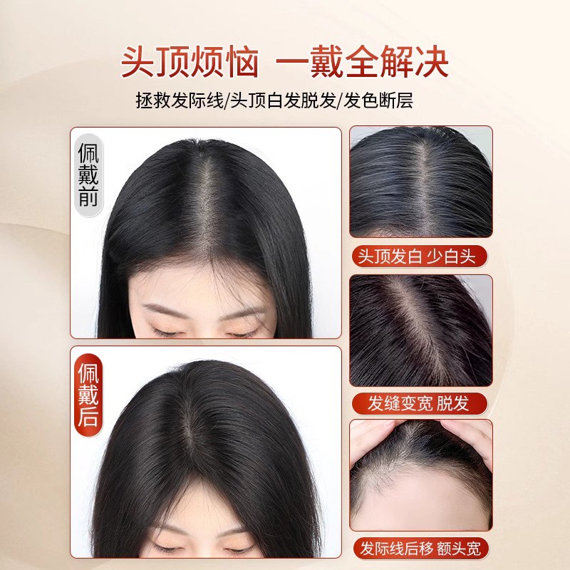 递针假发女片头顶真发自然遮白D发蓬松高颅顶增发量刘海补发片