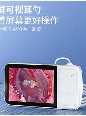 采耳专用4.5寸1080P高清洁耳发光耳勺3.9mm可视挖耳勺带屏