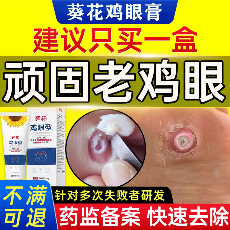 葵花】鸡眼膏冠军趾疣瘊子一抹灵