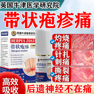 带状疱疹蛇缠腰后遗症神经痛疱疹疼痛膏药贴蛇盘疮疱疹止痛喷剂YY
