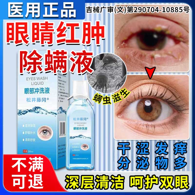 医用洗眼液清洁抗菌消炎眼睛有螨虫异物感眼干眼痒除螨眼药水ZT - 实物图