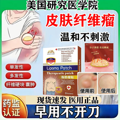 美国研究医学院-泉复康-脂肪瘤贴
