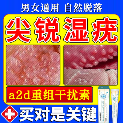 【医用级】尖锐湿疣无痛脱落