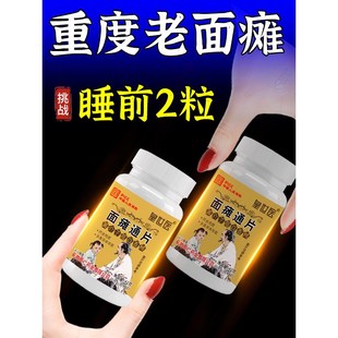 面瘫通片面瘫嘴歪眼斜面部抽搐面肌痉I挛草本萃取黄介子薤白香橼