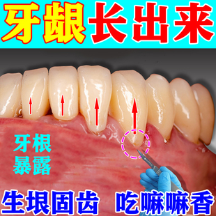 极速【牙龈再长】萎缩修复牙晃动牙根外露肿痛Q出血酸软无力护理