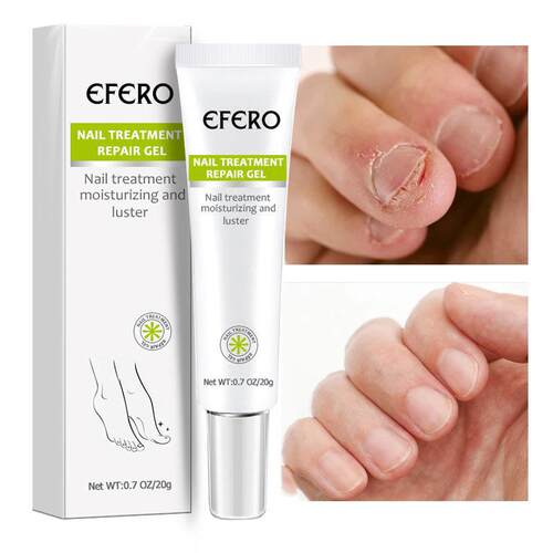 新品.Hot Efero Fungal Nail  Repair EssencMe Foot Nail Fungus