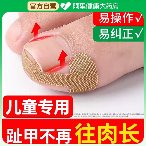 【儿童专用】皮肤科推荐甲沟矫正