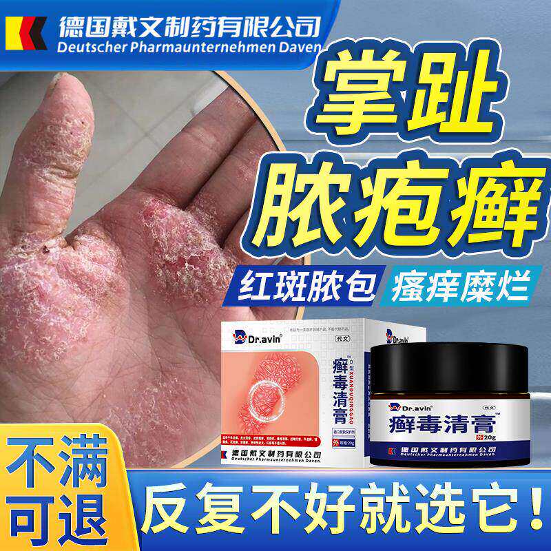 掌趾脓疱病症专用角化手脚