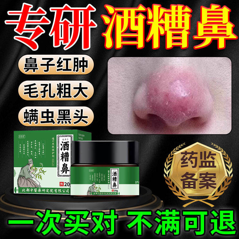 酒糟鼻草莓鼻改善红鼻子膏毛孔粗大玫瑰青春痘黑头粉刺螨虫专用PR