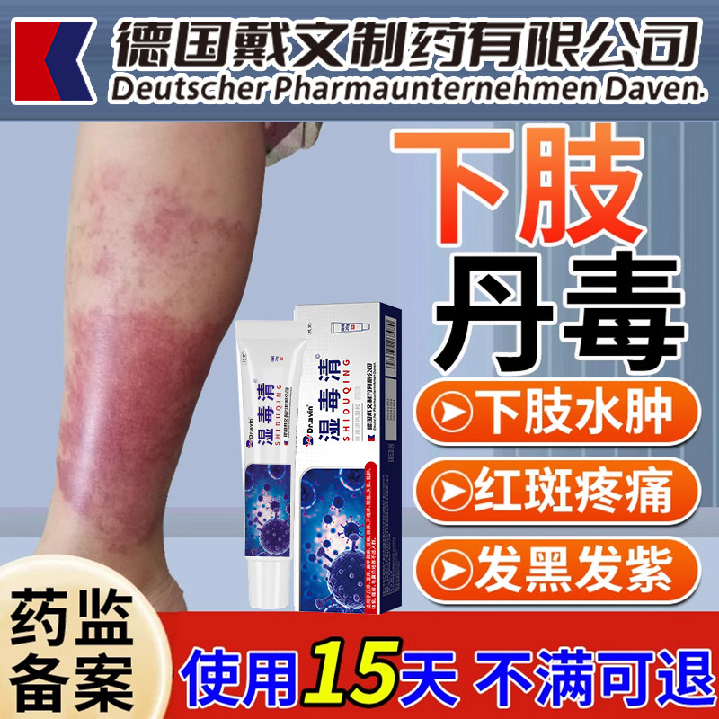 丹毒专用软膏小腿红斑修疼