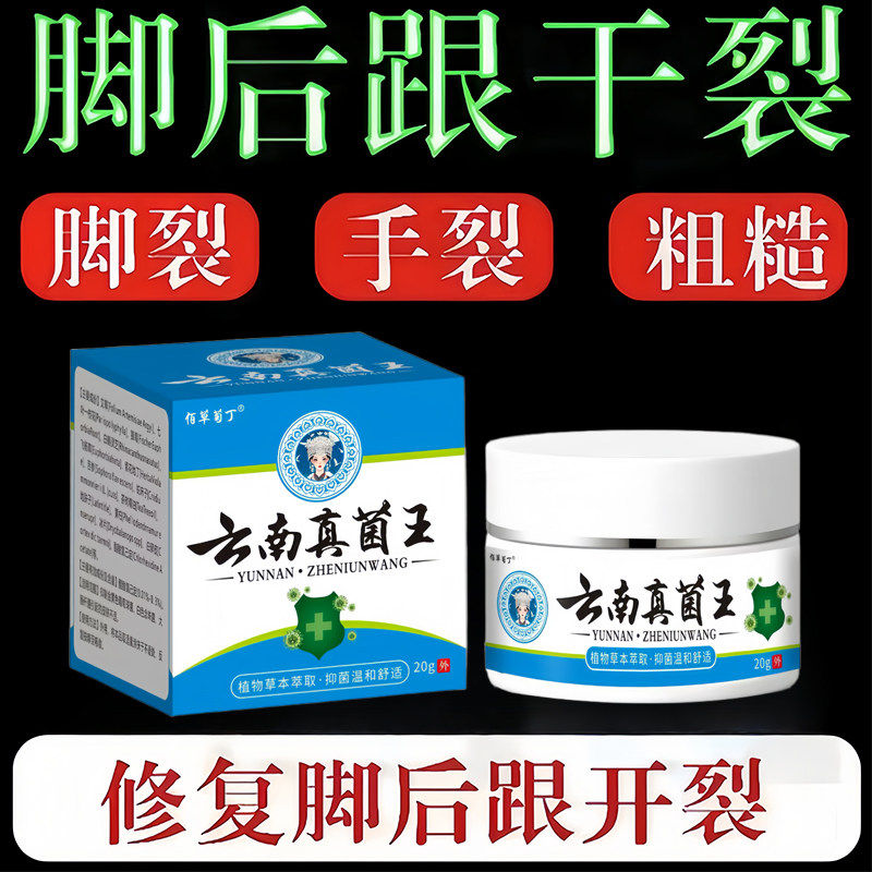云南真菌王脚后跟手足脱皮