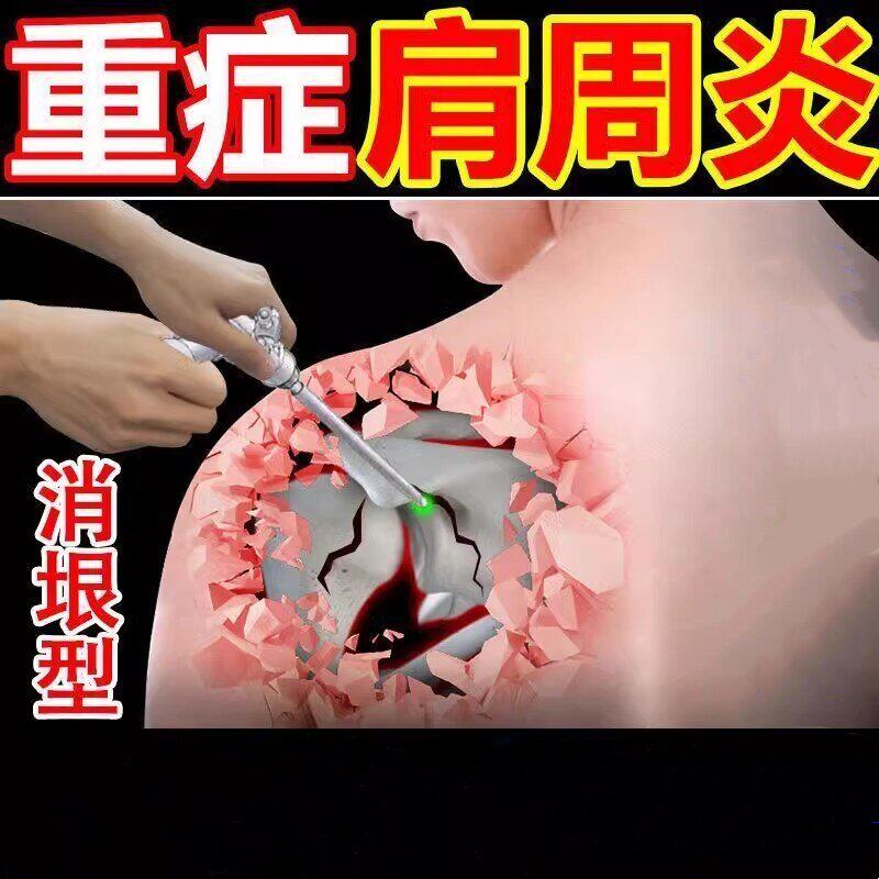 肩周炎专用贴膏膀关节疼痛