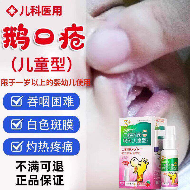 宝宝鹅口疮婴儿喷剂制霉菌素片碳酸氢钠溃疡婴儿鹅口疮凝胶