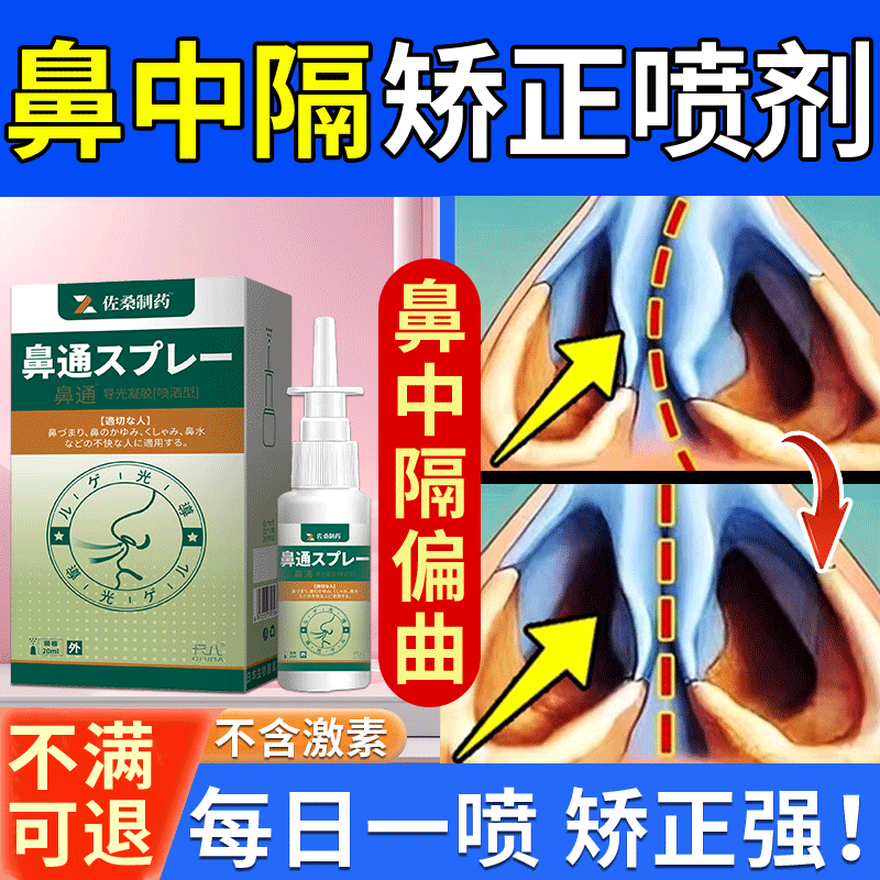 鼻中隔偏曲矫正器药房同售