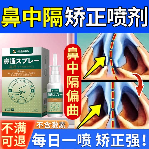 鼻中隔偏曲矫正器药房同售