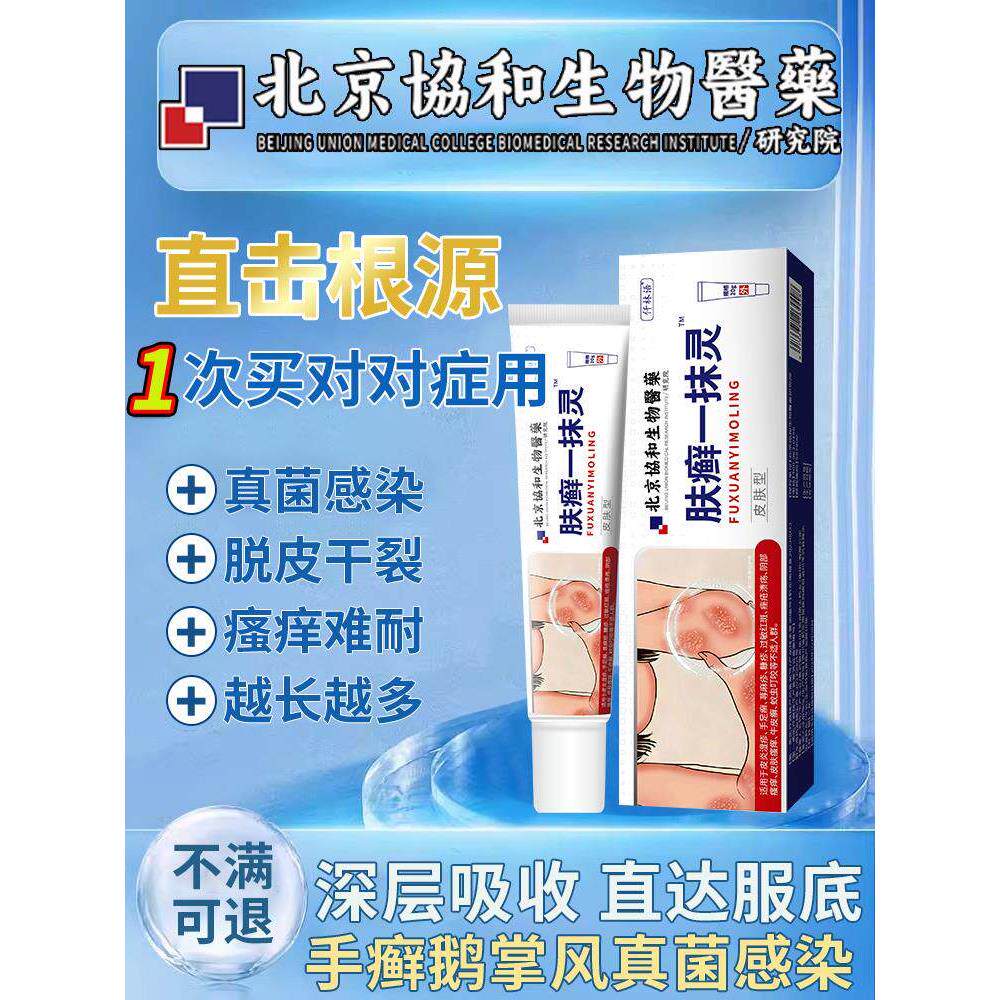 手癣膏脱皮干裂真菌感染足