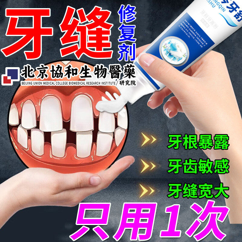 牙缝宽大修复神器补填充疼