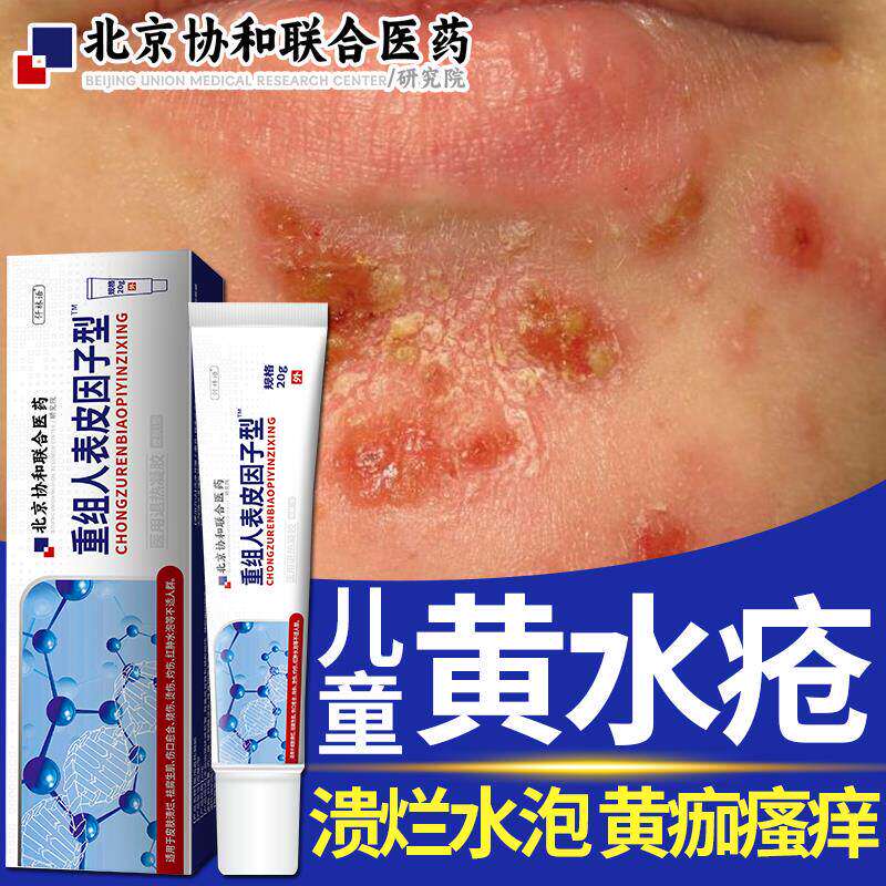 黄水疮药房同款膏脓包传染