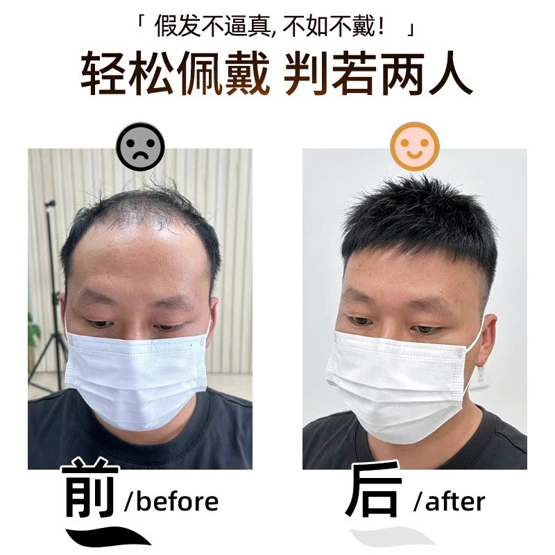 假发男短发手织真发无痕隐形薄透气假发片男士头顶补发片全头刘海