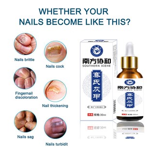 极速Nail Fungus atment Feetx Care Essence Nails Foot Repair