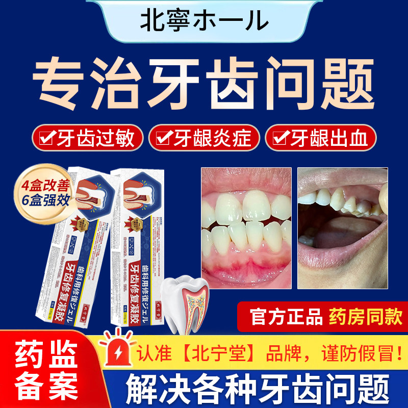 北宁堂牙齿修复凝胶牙龈萎缩松动出血牙周炎固齿抗敏膏官方正品