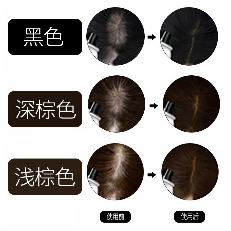 纯植物头发密发增发纤维粉喷雾发际线粉快速补发神器遮秃头顶男女